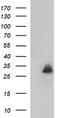 Mannose Binding Lectin 2 antibody, M01000, Boster Biological Technology, Western Blot image 