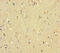 Uncharacterized protein CXorf1 antibody, A62354-100, Epigentek, Immunohistochemistry paraffin image 