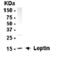 Leptin antibody, XW-7340, ProSci, Western Blot image 
