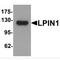 Lipin 1 antibody, MBS153394, MyBioSource, Western Blot image 