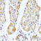 Mitochondrial Ribosomal Protein L11 antibody, A11059-1, Boster Biological Technology, Immunohistochemistry paraffin image 