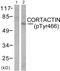 Src substrate protein p85 antibody, PA5-38130, Invitrogen Antibodies, Western Blot image 