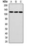 Inv antibody, LS-C668408, Lifespan Biosciences, Western Blot image 