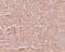 Solute Carrier Family 39 Member 14 antibody, A04761, Boster Biological Technology, Immunohistochemistry paraffin image 