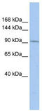 TATA-Box Binding Protein Associated Factor 3 antibody, TA339161, Origene, Western Blot image 
