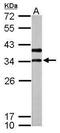 ATPase H+ Transporting V1 Subunit D antibody, PA5-31371, Invitrogen Antibodies, Western Blot image 