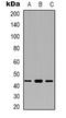 Branched Chain Amino Acid Transaminase 1 antibody, LS-C368945, Lifespan Biosciences, Western Blot image 