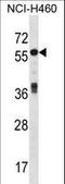 Islet cell autoantigen 1 antibody, LS-C165103, Lifespan Biosciences, Western Blot image 