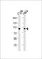 Signal Transducer And Activator Of Transcription 1 antibody, LS-C203922, Lifespan Biosciences, Western Blot image 