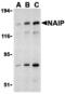 Baculoviral IAP repeat-containing protein 1 antibody, MBS151490, MyBioSource, Western Blot image 