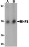 Ring Finger Protein 8 antibody, A00707, Boster Biological Technology, Western Blot image 