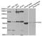 OCA2 Melanosomal Transmembrane Protein antibody, PA5-76768, Invitrogen Antibodies, Western Blot image 