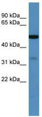 Palmitoyltransferase ZDHHC3 antibody, TA342658, Origene, Western Blot image 