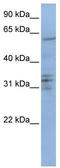 Centromere Protein B antibody, TA340025, Origene, Western Blot image 