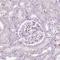 CES2 antibody, HPA046717, Atlas Antibodies, Immunohistochemistry paraffin image 