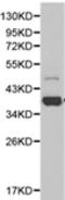 Serine/threonine-protein phosphatase PP1-alpha catalytic subunit antibody, TA323467, Origene, Western Blot image 