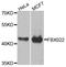 F-Box Protein 22 antibody, A8367, ABclonal Technology, Western Blot image 