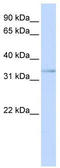 ETS Variant 3 Like antibody, TA342395, Origene, Western Blot image 
