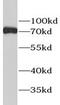 Estrogen Receptor 1 antibody, FNab02822, FineTest, Western Blot image 