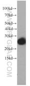 Rho-GDI beta antibody, 66054-1-Ig, Proteintech Group, Western Blot image 