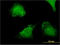 Acid Phosphatase 5, Tartrate Resistant antibody, LS-C196603, Lifespan Biosciences, Immunofluorescence image 