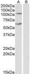 Iron regulatory protein 2 antibody, GTX88335, GeneTex, Western Blot image 