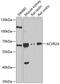 Activin A Receptor Type 2A antibody, GTX64724, GeneTex, Western Blot image 