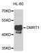 Doublesex And Mab-3 Related Transcription Factor 1 antibody, STJ110709, St John