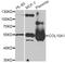 Collagen Type X Alpha 1 Chain antibody, LS-B14811, Lifespan Biosciences, Western Blot image 