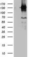 Poly(ADP-ribose) glycohydrolase antibody, CF808614, Origene, Western Blot image 