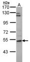Prolyl 4-hydroxylase subunit alpha-2 antibody, NBP2-19665, Novus Biologicals, Western Blot image 