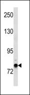 Zinc Finger Protein 12 antibody, LS-C203865, Lifespan Biosciences, Western Blot image 