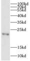 Complexin-4 antibody, FNab01924, FineTest, Western Blot image 