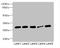 Insulin Like Growth Factor Binding Protein 1 antibody, A54583-100, Epigentek, Western Blot image 