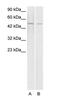 ETS Transcription Factor ERG antibody, PA1-24327, Invitrogen Antibodies, Western Blot image 