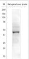 Potassium Voltage-Gated Channel Subfamily J Member 10 antibody, NBP1-70371, Novus Biologicals, Western Blot image 