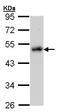 LIM Domain Binding 1 antibody, ab96799, Abcam, Western Blot image 