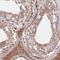 Centrosomal Protein 295 antibody, HPA038596, Atlas Antibodies, Immunohistochemistry paraffin image 