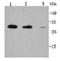 Catenin Beta 1 antibody, orb155825, Biorbyt, Western Blot image 