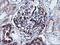 Schwannomin-interacting protein 1 antibody, LS-C786992, Lifespan Biosciences, Immunohistochemistry paraffin image 