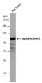 Actinin Alpha 2 antibody, PA5-29246, Invitrogen Antibodies, Western Blot image 