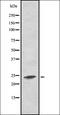 RAS Like Proto-Oncogene A antibody, orb336947, Biorbyt, Western Blot image 