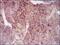 Maternal Embryonic Leucine Zipper Kinase antibody, MA5-17120, Invitrogen Antibodies, Immunohistochemistry paraffin image 