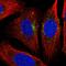 STARD3 N-Terminal Like antibody, HPA019204, Atlas Antibodies, Immunofluorescence image 