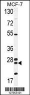 Nudix Hydrolase 8 antibody, 55-260, ProSci, Western Blot image 