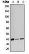 Monoglyceride Lipase antibody, orb198350, Biorbyt, Western Blot image 
