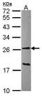 Glutathione S-Transferase Alpha 1 antibody, PA5-21890, Invitrogen Antibodies, Western Blot image 