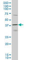 Homeobox D11 antibody, LS-C133893, Lifespan Biosciences, Western Blot image 