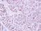 Pituitary Tumor-Transforming 2 antibody, GTX117149, GeneTex, Immunohistochemistry paraffin image 