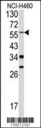 Yes Associated Protein 1 antibody, 62-327, ProSci, Western Blot image 